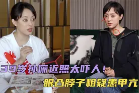 39岁孙俪近照太吓人！眼凸脖子粗被疑患甲亢，养生方式引争议视频封面
