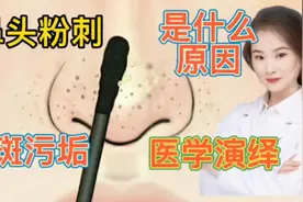 医学演绎 人体鼻子鼻头上面长出 粉刺黑头 黑斑 如何消除 ？视频封面