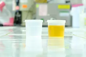 看病总要先查尿，尿常规检查能发现哪些疾病？医生一次给你说清楚视频封面