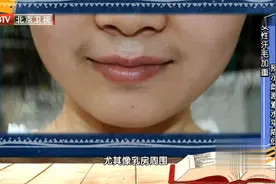 女性长“胡子”，汗毛加重？要注意，可能预示雌激素水平紊乱视频封面