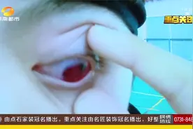 近距离扣杀！长沙少年遭羽毛球袭眼，痛到跪地右眼当即“失明”视频封面