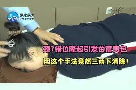 李德明：颈7错位隆起引发的富贵包，用这个手法竟然三两下消除！视频封面