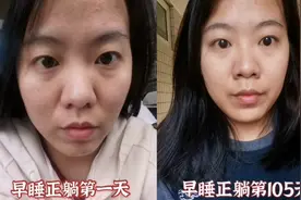 女子坚持286天10点早睡，前后对比惊人：泪沟法令纹都变浅了视频封面