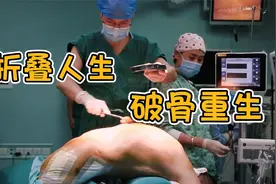 30年强直性脊柱炎患者，结束折叠人生，两次手术后：我站起来了视频封面