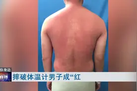 摔碎体温计男子汞中毒变红皮人 医生提醒：千万不要用手碰！视频封面