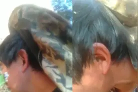 蜜蜂钻进男子耳朵弄不出来，朋友抽烟吹进耳朵，几分钟后被熏出视频封面