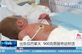 难度超乎想象!900克男婴早产还突发急性肺动脉栓塞,存活堪称奇迹视频封面