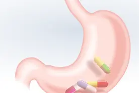 糜烂性胃炎吃什么药效果好？临床医师处方中，难逃这3种药视频封面