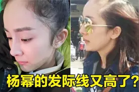 杨幂假发被突然掀掉，瞬间惊慌忙遮脸，网友：发际线又刷新了视频封面