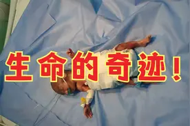 宝宝生出来还没巴掌大，却奇迹般活了过来，生命真是好神奇视频封面