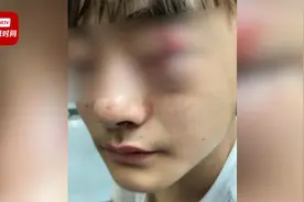 安徽一中学生未完成作业被老师打伤眼睛 教育局：老师是无意的视频封面