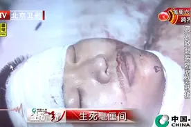 两位民警遇到袭击，身受重伤浑身是血，连眶骨都被砍折了！视频封面
