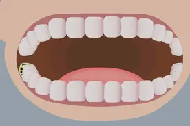 儿童虫牙疼怎么办？视频封面