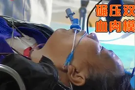 女子遭遇土方车碾压，双腿被压成一片血肉，真实纪录片视频封面