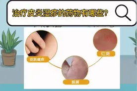 兰州皮肤病医院：治疗皮炎、湿疹的常用药物有哪些？视频封面