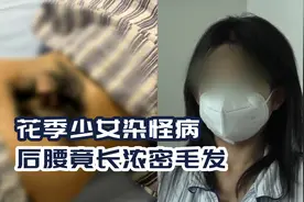17岁花季少女染怪病，后腰竟长浓密毛发，这到底是什么怪病？视频封面