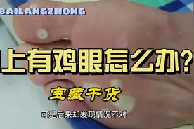 脚上长了鸡眼、跖疣，反复发作，一定要试试这味中药视频封面