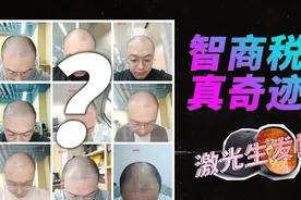 是智商税还是真奇迹？小米有品COSBEAUTY LLLT激光生发帽体验视频封面