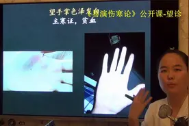 中医望诊望手掌发白主失血气血虚-易演伤寒论公开课视频封面