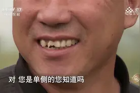 见过瓜子脸，但你见过标准的“瓜子牙”吗？