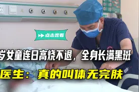 4岁女童连日高烧不退，全身长满黑斑，医生：真的叫体无完肤视频封面