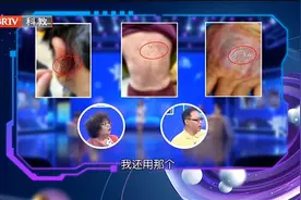 湿疹是什么样子，通过三张图，告诉你答案视频封面