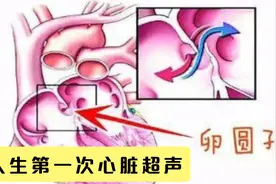 人生第一次心脏彩超，很多人都不正常！别怕！这不一定是心脏病视频封面