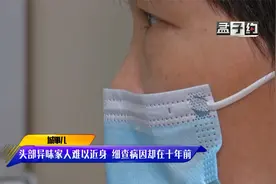 女子头部总有恶臭味！家人都没法靠近，病因竟在10年前视频封面