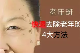 臉上冒出「老年斑」，教你1個土方法，她激動的哭了「斑沒了」视频封面