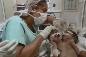 双头男婴：世界罕见！初为人母却发现是双头连体婴，医生全力救治视频封面