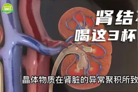 肾结石的“克星”已找到！喝这3杯水，排出结石，不给肾脏添麻烦视频封面