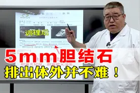 5毫米胆结石，用这个方法，已经排出体外！ 不用非得做手术！视频封面