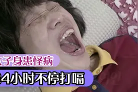 女子身患怪病，24小时不停打嗝，病因终被查明视频封面