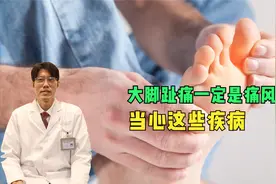 大脚趾痛一定是痛风吗？一般是哪个部位开始痛？听专家说