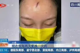 “密室逃脱”暗藏安全隐患，女子额头遭了殃，3小时缝了60多针视频封面