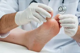 脚气痒得受不了，曲安奈德益康唑乳膏可有效抗真菌，能治脚气吗？视频封面