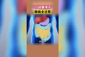 3D动画演示，肠镜的全过程视频封面