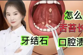 医学演绎 人体舌苔口腔长满结石口腔溃疡怎么样 看医生如何处理视频封面