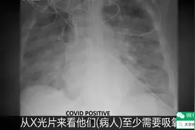 X光片告诉你：接不接种新冠疫苗有什么区别…视频封面