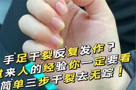 常年手脚干裂粗糙？过来人随便支你几招，皮肤瞬间嫩滑不开裂！视频封面
