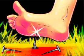 如果一个生锈的钉子戳到了你的脚怎么办？视频封面