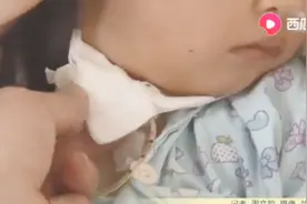 筷子从脖子插入,穿过气管直抵颅底,两岁女孩遭遇惊魂一刻!视频封面