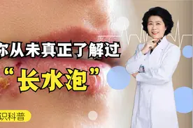 嘴角反复长水泡，这是怎么回事？可别以为只是上火，严重会传染！视频封面