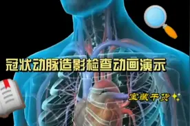 冠状动脉造影动画演示视频封面