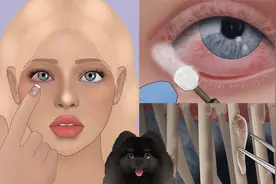美女也有烦恼 | 眼部护理过程，去除睫毛螨虫 | 定格动画视频封面