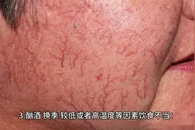 脸上突然长了红血丝是怎么回事，应该注意什么！视频封面