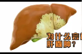 为什么会得肝囊肿？哪种肝囊肿需要治疗？视频封面