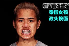 最强整容术.泰国可怜女孩是如何改头换面的视频封面