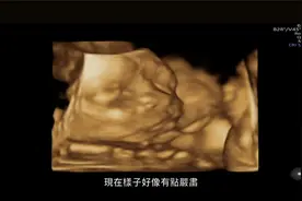 怀孕21周四维彩超产检过程全记录，宝宝生气打哈欠都能看得到！视频封面