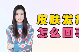 脸痒是什么原因造成的，脸部皮肤发痒怎么回事？视频封面